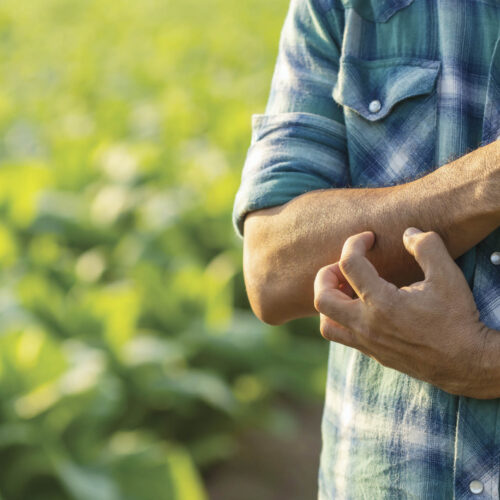 Managing mozzies in the garden Person scratching mosquito bites on their arm.