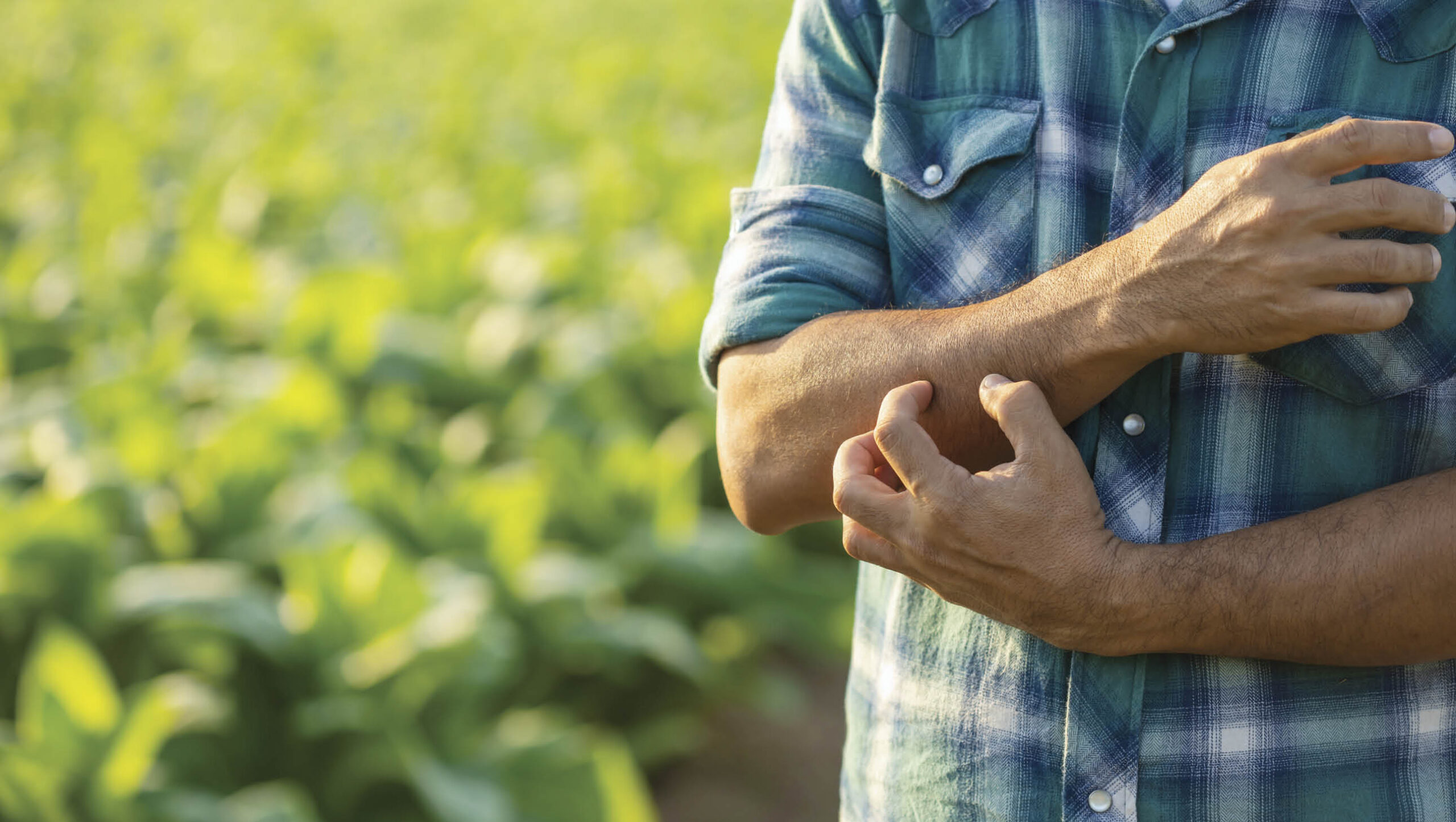 Managing mozzies in the garden Person scratching mosquito bites on their arm.